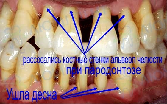 сон