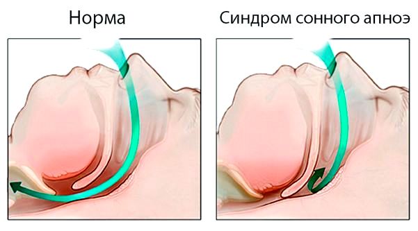 страх